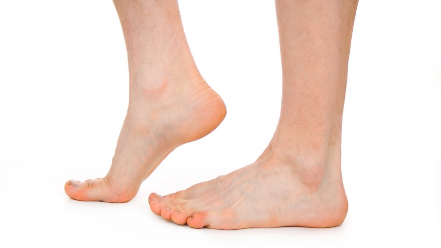 Do I need orthotics?